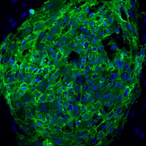 ssea4_647_-25_merged_crop.png